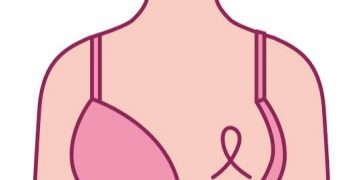Kemisola's Smart Bra for breast cancer detection