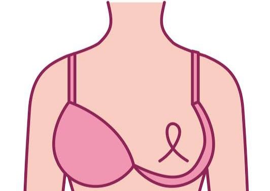 Kemisola's Smart Bra for breast cancer detection